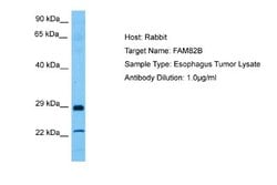 RMD1 Rabbit anti-Human, Polyclonal, Novus Biologicals 0.1 mL | Buy Online | Novus Biologicals | Fisher Scientific